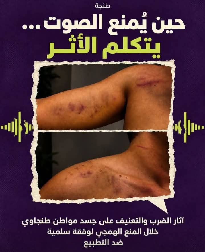 طنجة تهتز على وقع توقيف أزيد من 60 متضامناً مع فلسطين.. والفدرالية المغربية لحقوق الإنسان تدق ناقوس الخطر وتطالب بتحقيق عاجل